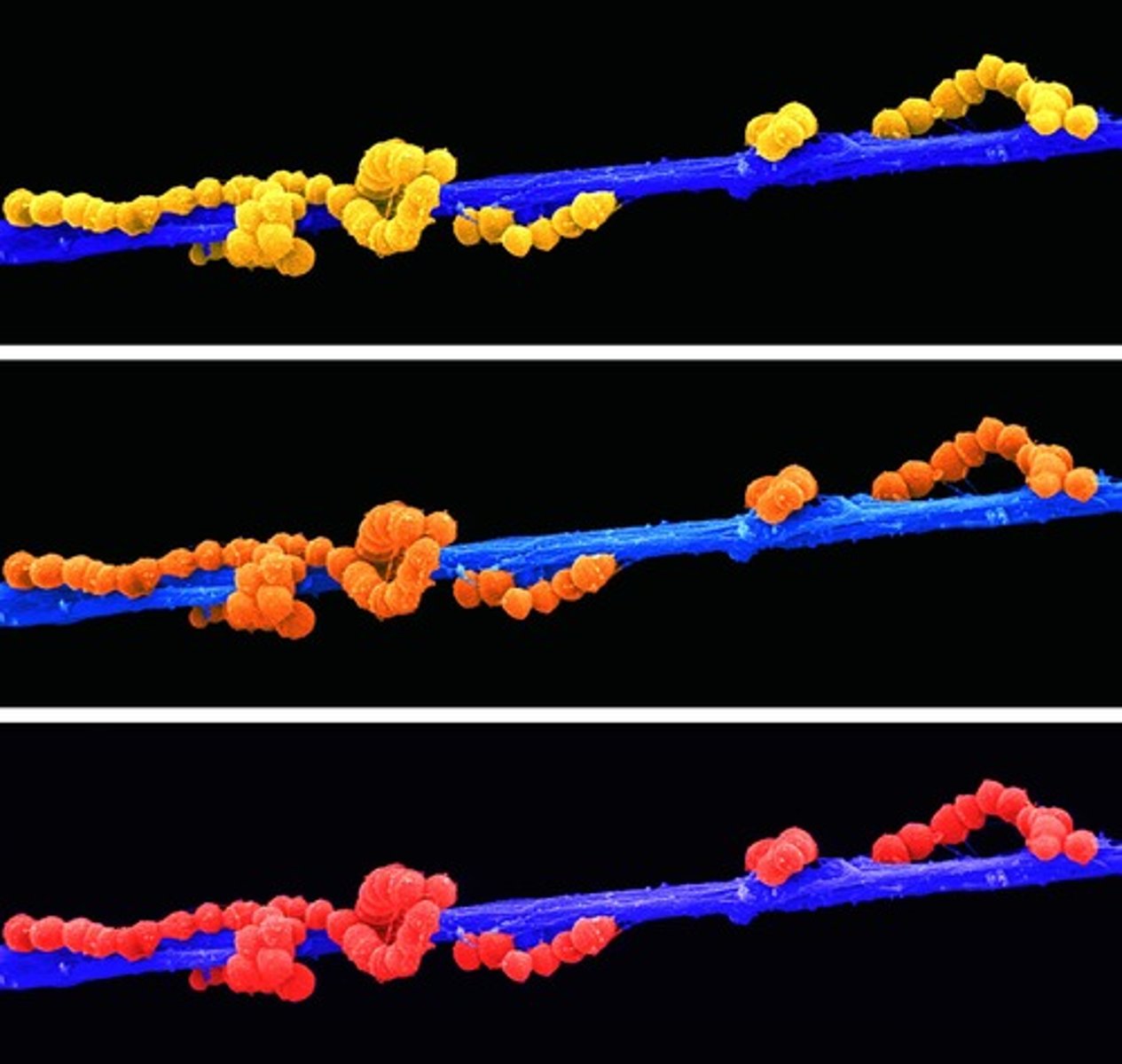 <p>twisted chains</p>