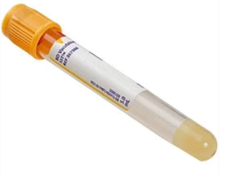<p>Yellow</p>