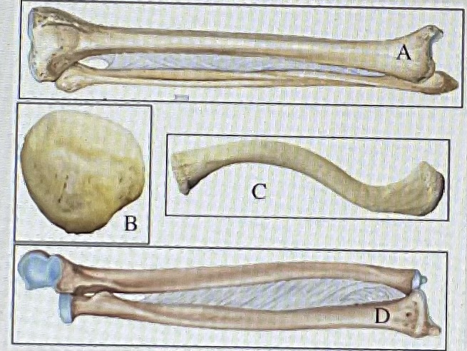 <p>based on the figure above identify each bone</p>