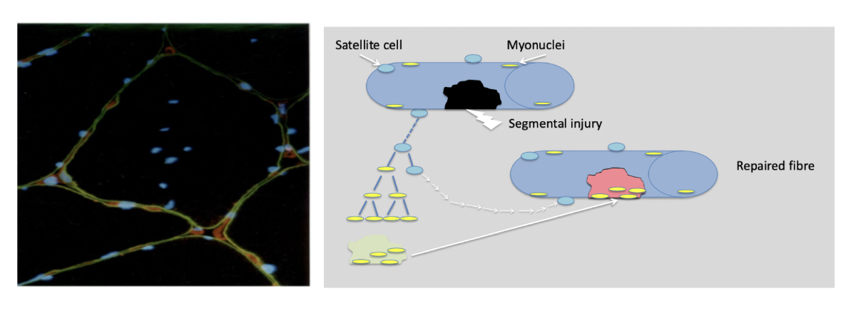 <p>I muskelcellerna ökar mängden myonuclei genom proliferation av satellitceller. <span><strong>Muskel-satellitceller</strong> kan skapa nya kärnor eftersom muskelceller inte kan dela sig. Normalt är satellitcellerna vilande men de aktiveras vid träning. De börjar producera <strong>aktin</strong> <strong>och</strong> <strong>myosin</strong> som reparerar det trasiga segmentet. Därför ökar muskelvävnad vid träning.</span></p>