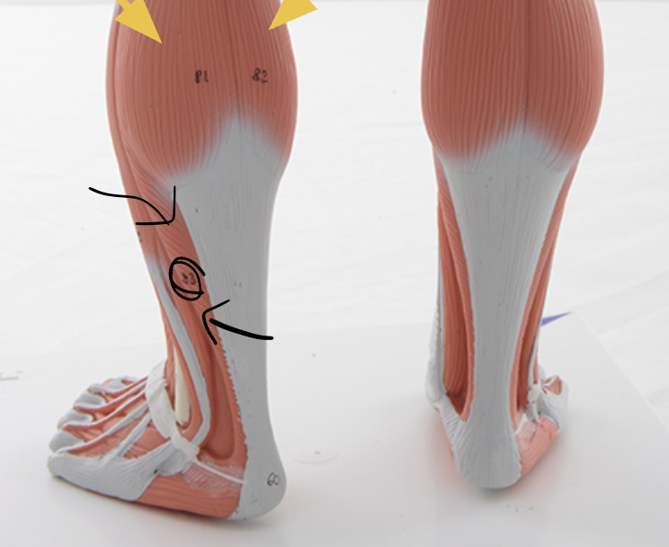 <p>soleus m. </p><p><span>O: posterior surface of fibula and tibia&nbsp;</span></p><p><span>I: calcaneus</span></p><p><span>Action(s): plantar flexion</span></p><p><span>Innervated by tibial nerve</span></p>