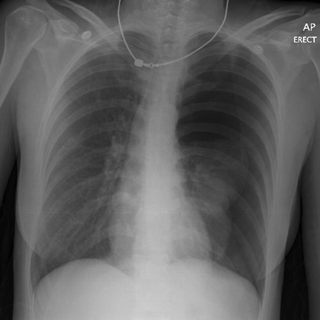 <p>Describe the abnormality demonstrated.</p>