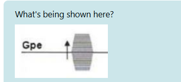 <p>FEG being turned on during readout.</p><p style="text-align: left">SEG turned on during the RF.</p><p style="text-align: left">90 degree excitation pulse</p><p style="text-align: left">PEG turned on to a different strength every TR.</p><p><br></p>
