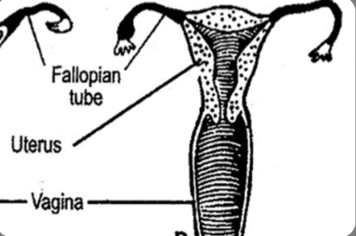 What type of uterus is this?