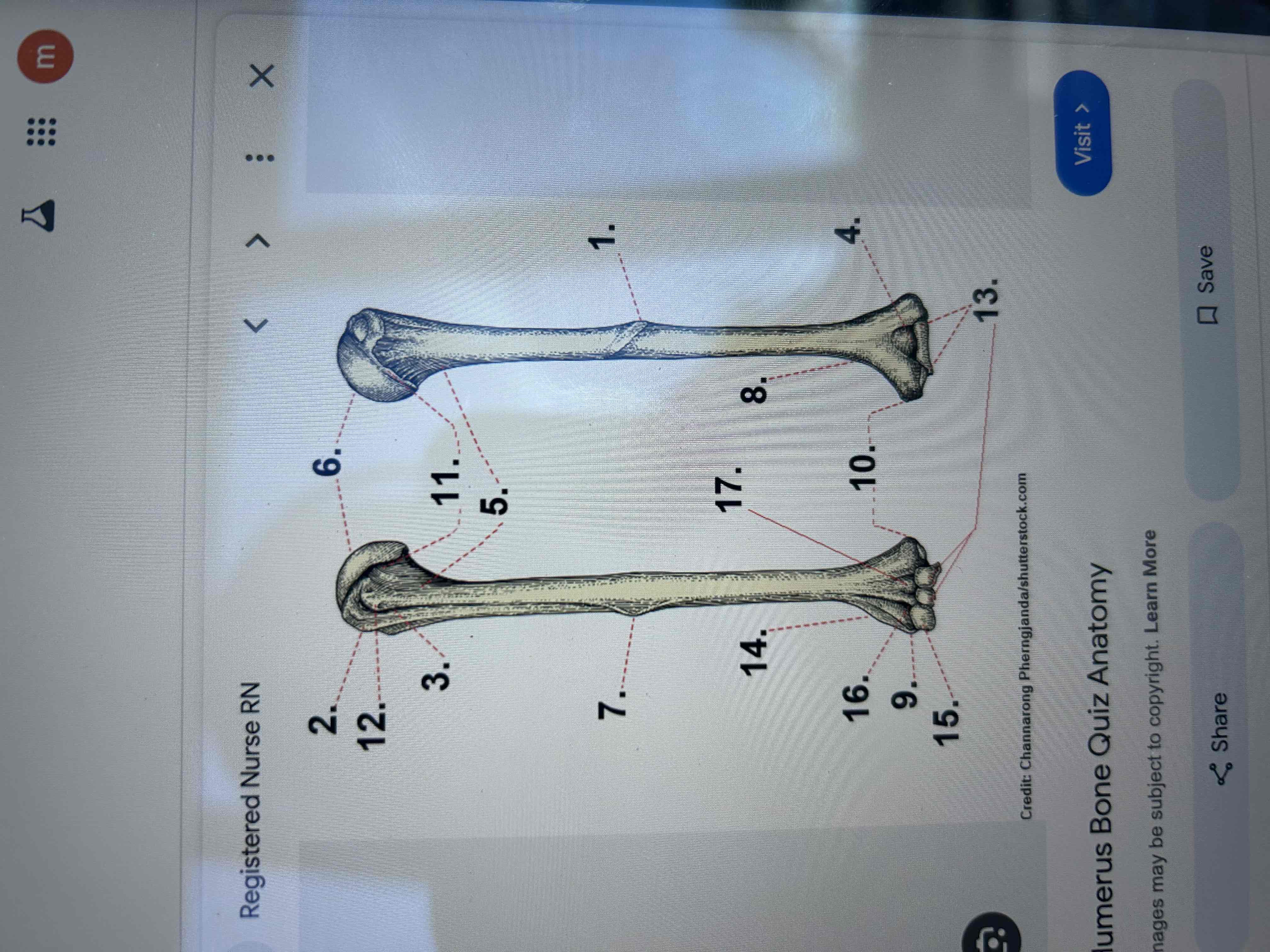 <p>Identify numbers 13 &amp;6</p>
