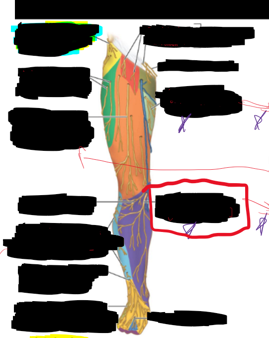 <p>What is the structure circled?</p>