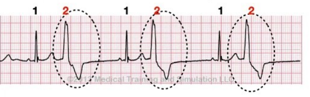 <p>What rhythm is this?</p>