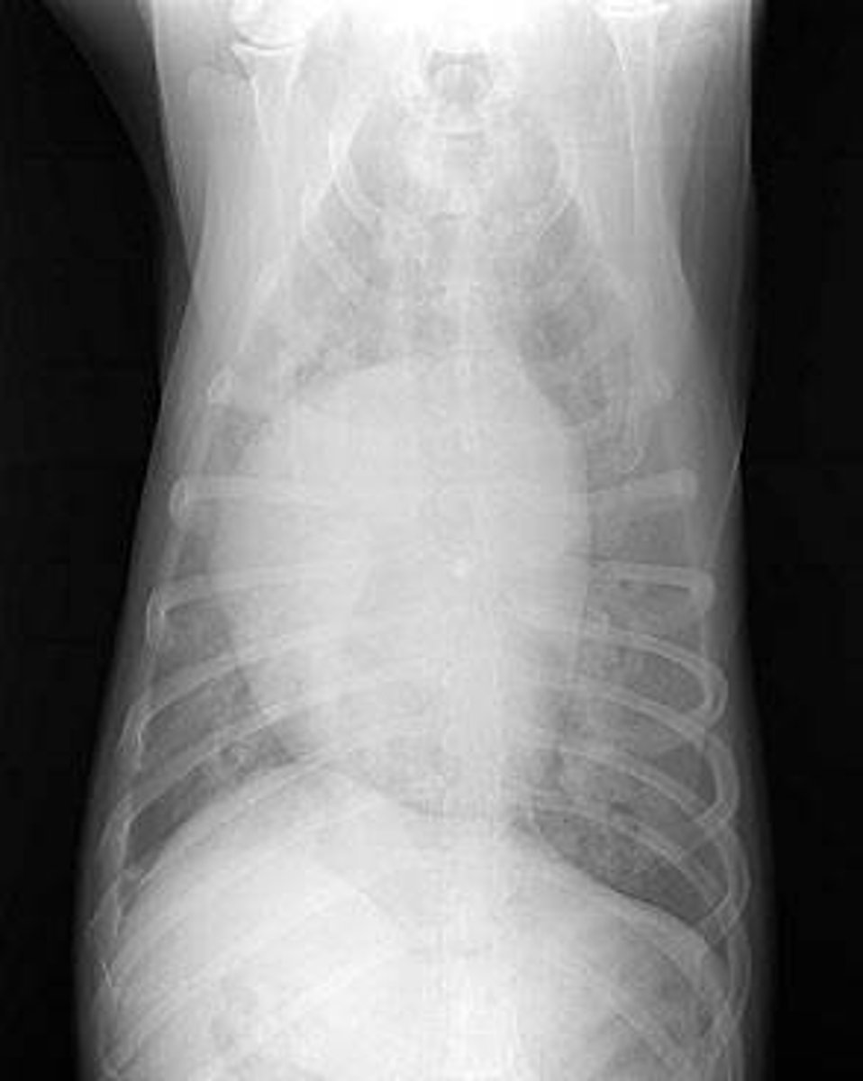 <p>What distinctive feature seen in the radiograph of this dog is pathognomonic for canine heartworm infection?</p>