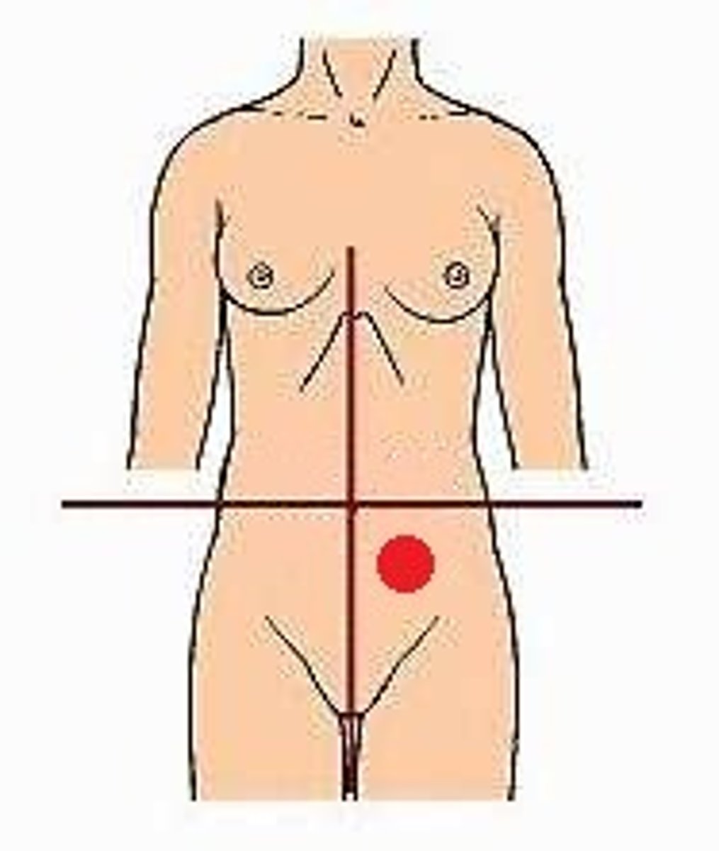 <p>Location:</p><p>Left of midline, inferior to transverse plane through umbilicus</p><p>Description:</p><p>Lower left lateral area of abdominopelvic cavity</p><p>Contents include parts of small intestine, large intestine, urinary bladder (when distended), and left uterine tube and ovary</p>