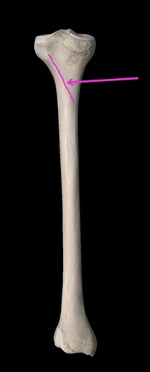 <p>shallow linear elevation</p>