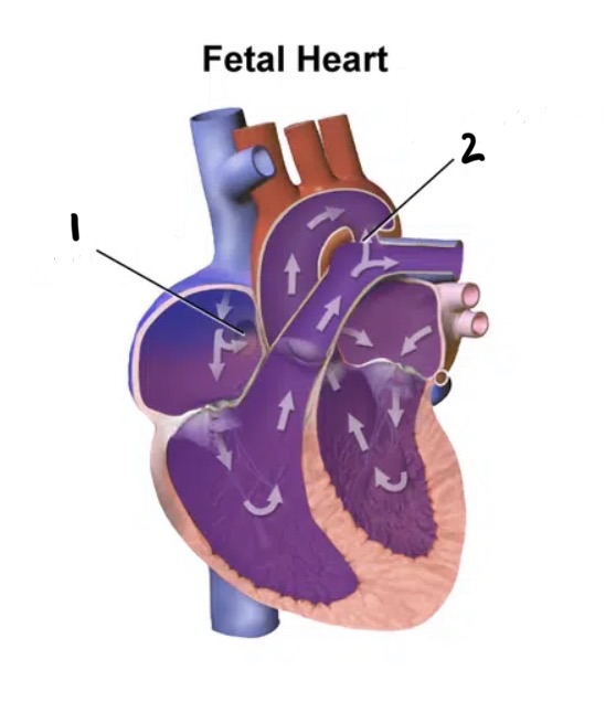<p>Holes in the fetal heart</p>