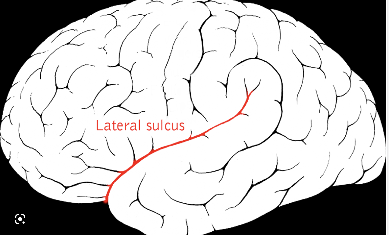 <p>The lateral sulcus (Sylvian fissure) is a very deep fold seen on the lateral surface of the hemisphere running in an anterior to posterior direction and serves to separate the temporal lobe from the frontal and parietal lobes.</p>