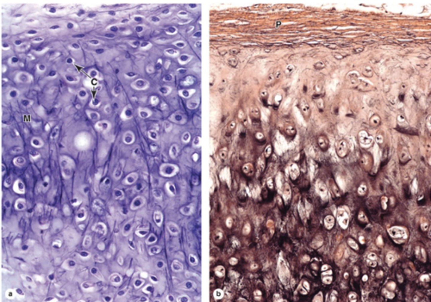 <p>How does elastic cartilage compare to hyaline cartilage?</p>
