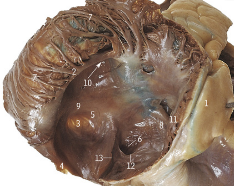 <p>What is the smooth area of the right atrium called?</p>