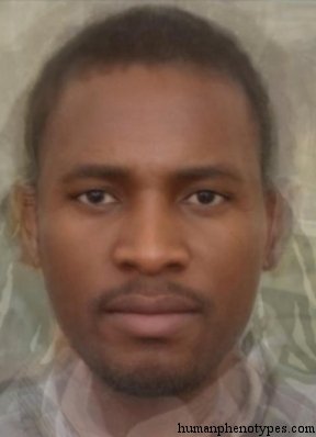 <p>Identify this Phenotype</p>