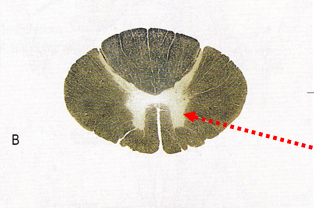 <p>Which spinal cord segment?</p>