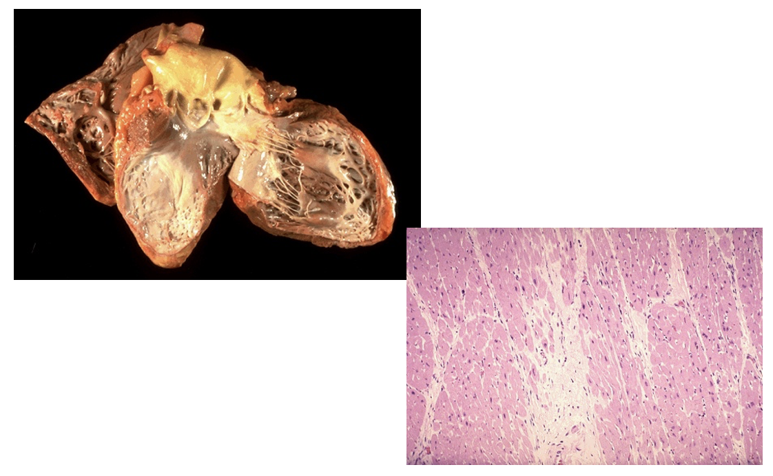 <p>Pathological aspects of wound healing:</p><p>What does this example depict?</p>