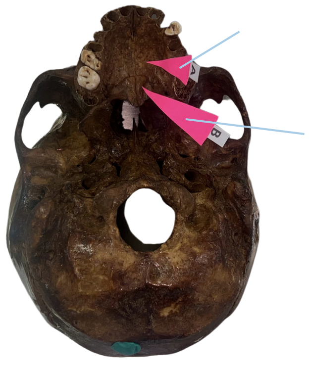 <p>Identify the structure of the skull labelled B.</p>