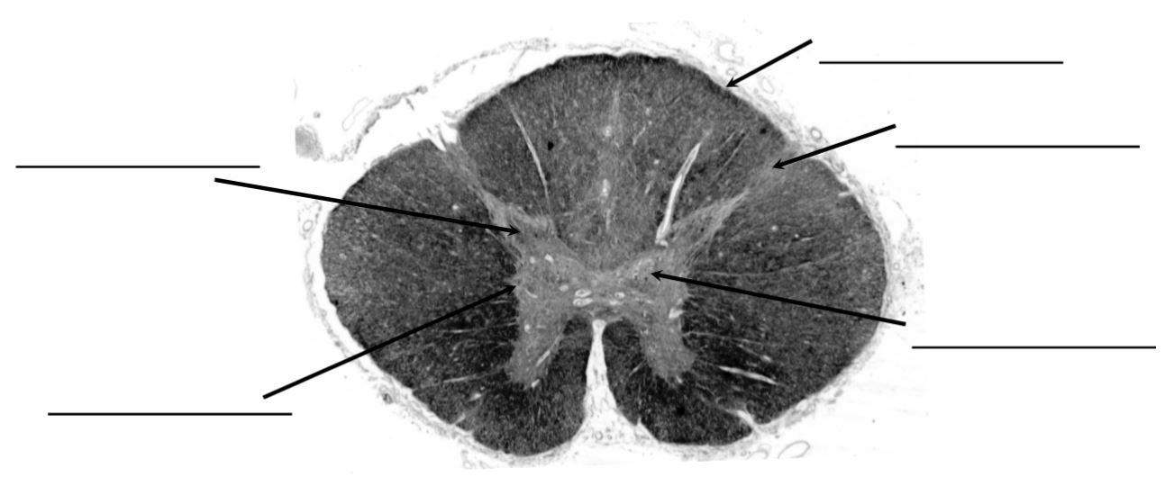 <p>identify this spinal level</p>