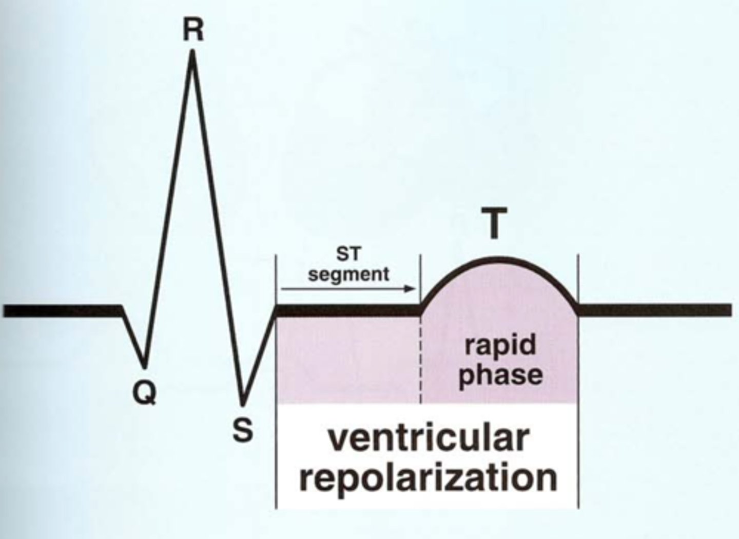 <p>Rapid repolarization of the ventricles is represented by T-wave on EKG.</p>