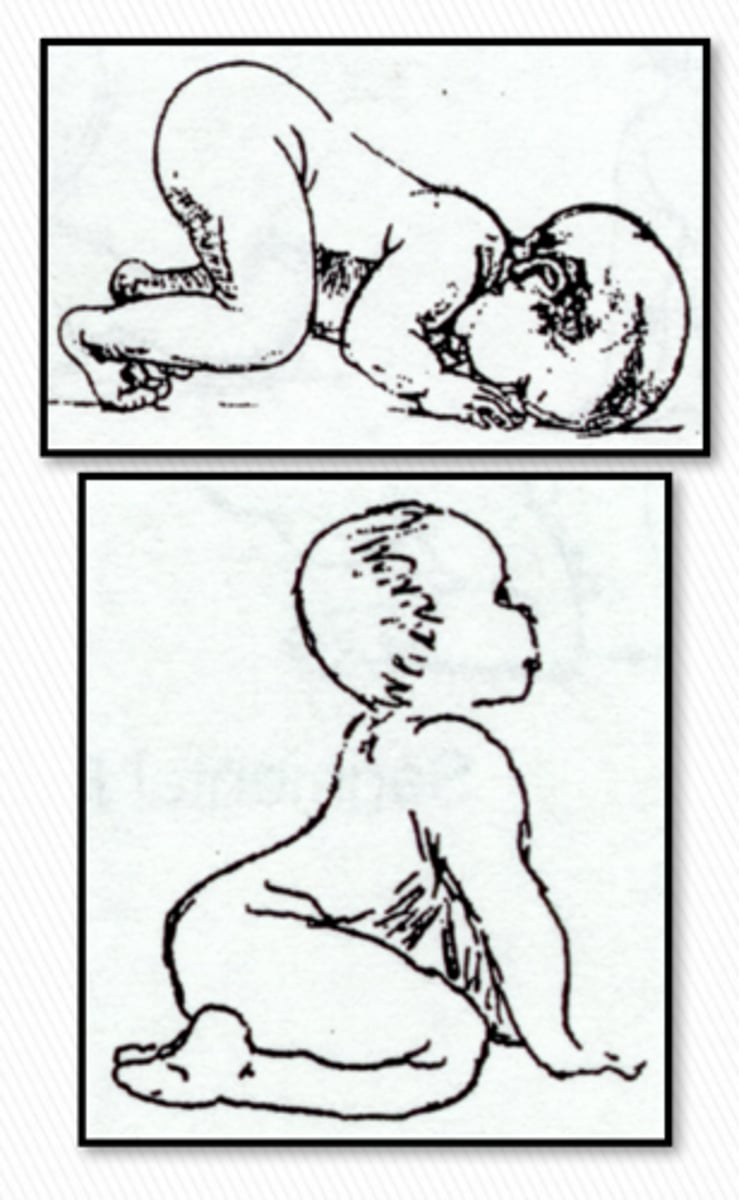 <p>Stim: flexion or extension of head</p><p>Response:</p><p>-Head Flexion: UE flexion and LE extension</p><p>-Head Extension: UE extension and LE flexion</p><p>Onset: 4-6 mo</p><p>Integration: 8-12 mo</p>