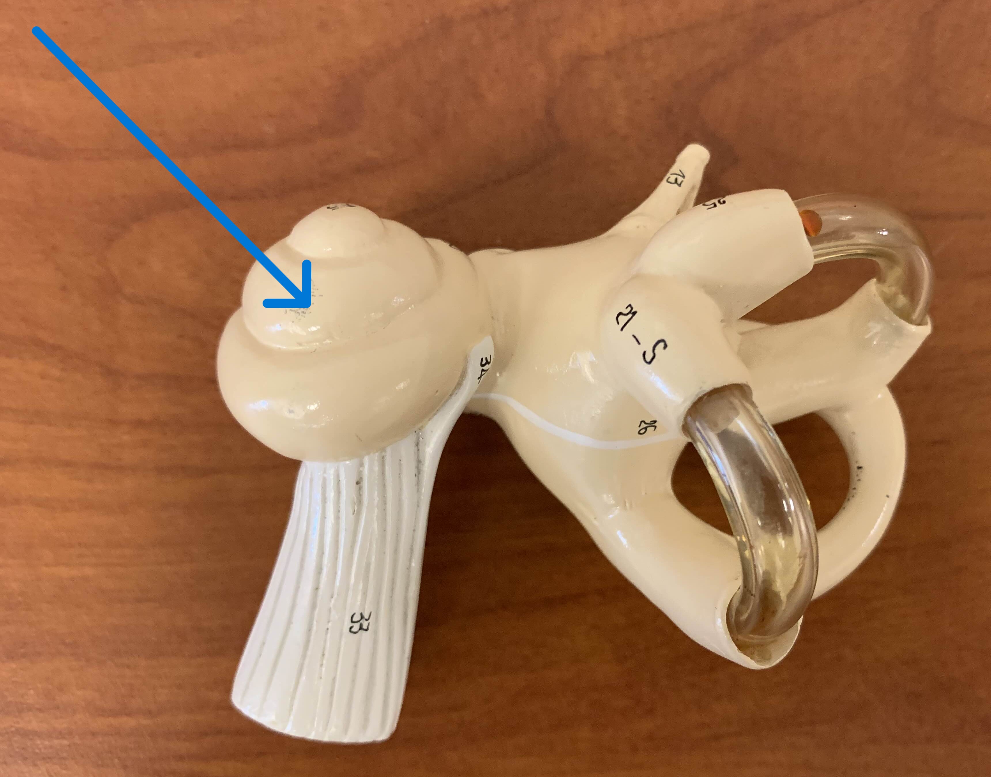 <p>Which part of the ear is:</p><ul><li><p>Spiral-shaped</p></li><li><p>Whole entire shell</p></li></ul><p></p>