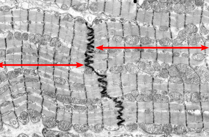 <p>Cell type</p>