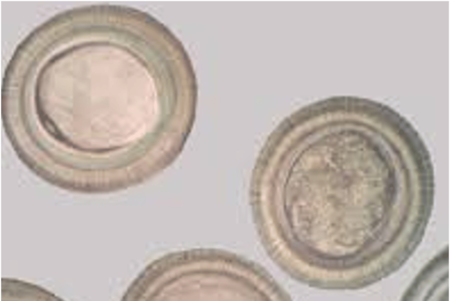 <p>round, corticated, has segments, non distinguishing</p>