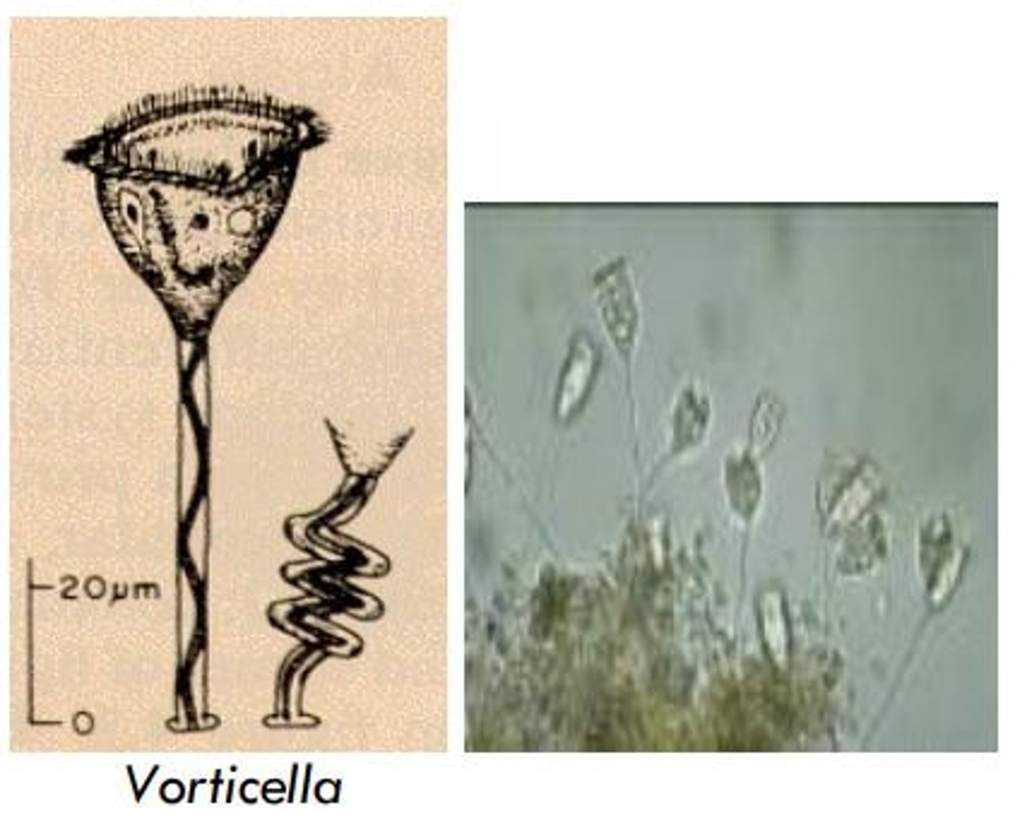 <p>Using a microscope to examine the motility of protozoa and draw the observed parasites.</p>