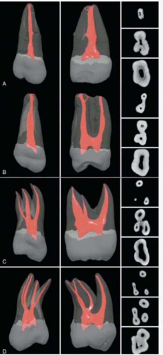 <p>3/4</p>