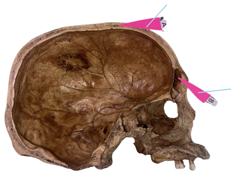 <p>Identify the structure of the skull labelled B.</p>