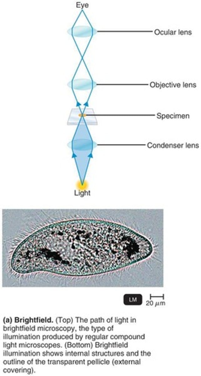 <p>The limit of resolution is 0.2 µm.</p>