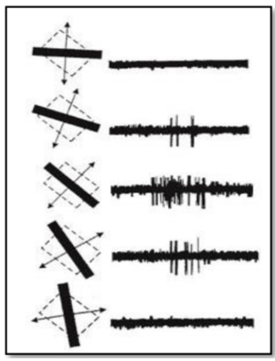 <p>______ is very sensitive to elongated stimuli and their orientation</p>