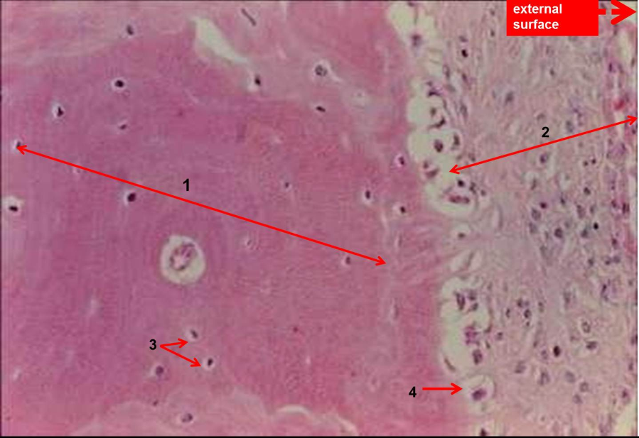 <p>1. What&nbsp; special name is used to describe the functional unit of compact bone indicated by arrow 1?</p><p>2. What specific name is given to the tissue that covers the outer surface of compact bone - labelled 2?</p><p>3. Identify and name the cells embedded in the osteoid -labelled 3?</p><p>4. What is the precise functional role of the cells&nbsp;labelled 4 </p>