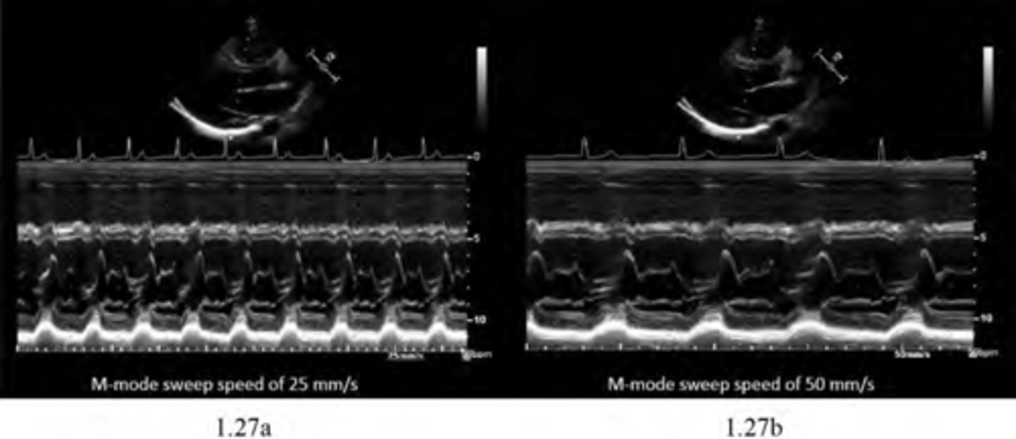 <p>Changes a number of cardiac cycles that can be is shown on the horizontal axis of the M-mode display.</p>