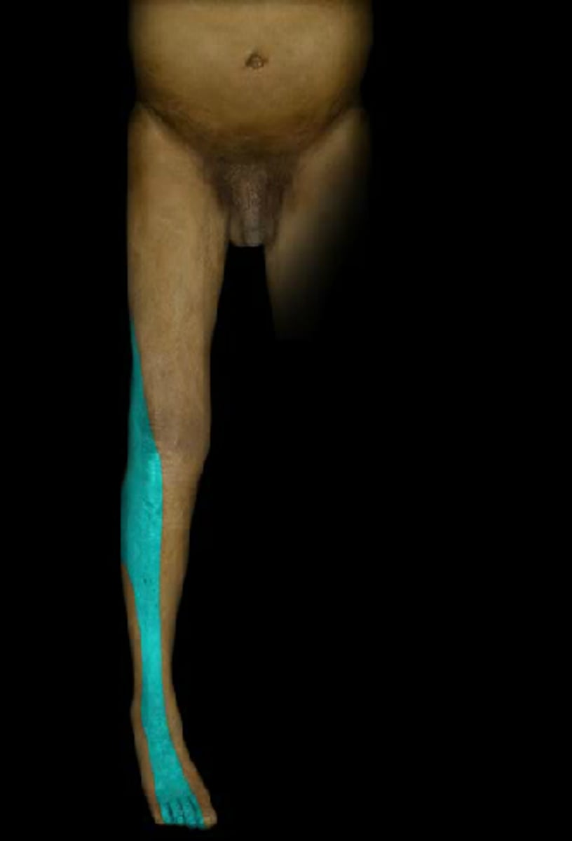 <p>Low back pain, paresthesia to top of foot, weakness in L5-innervated muscles (great toe extensors)</p>