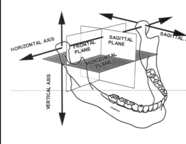 <p>sagittal</p><p>medial</p><p>horizontal </p><p>frontal </p>