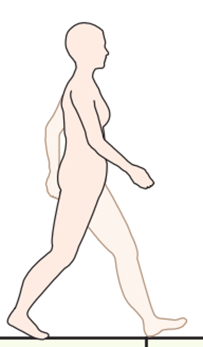 <p>What stance is this according to Ranchos Los Amigos?</p>