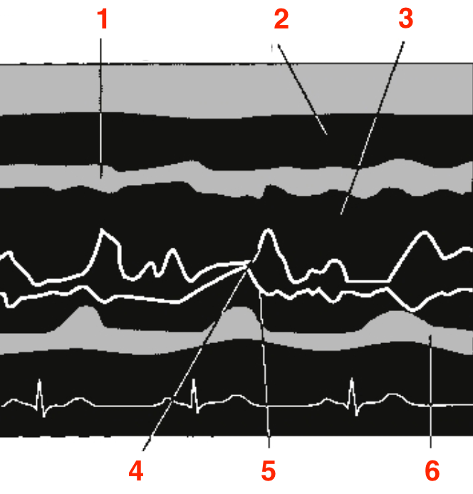 <p>Identify this image. </p>
