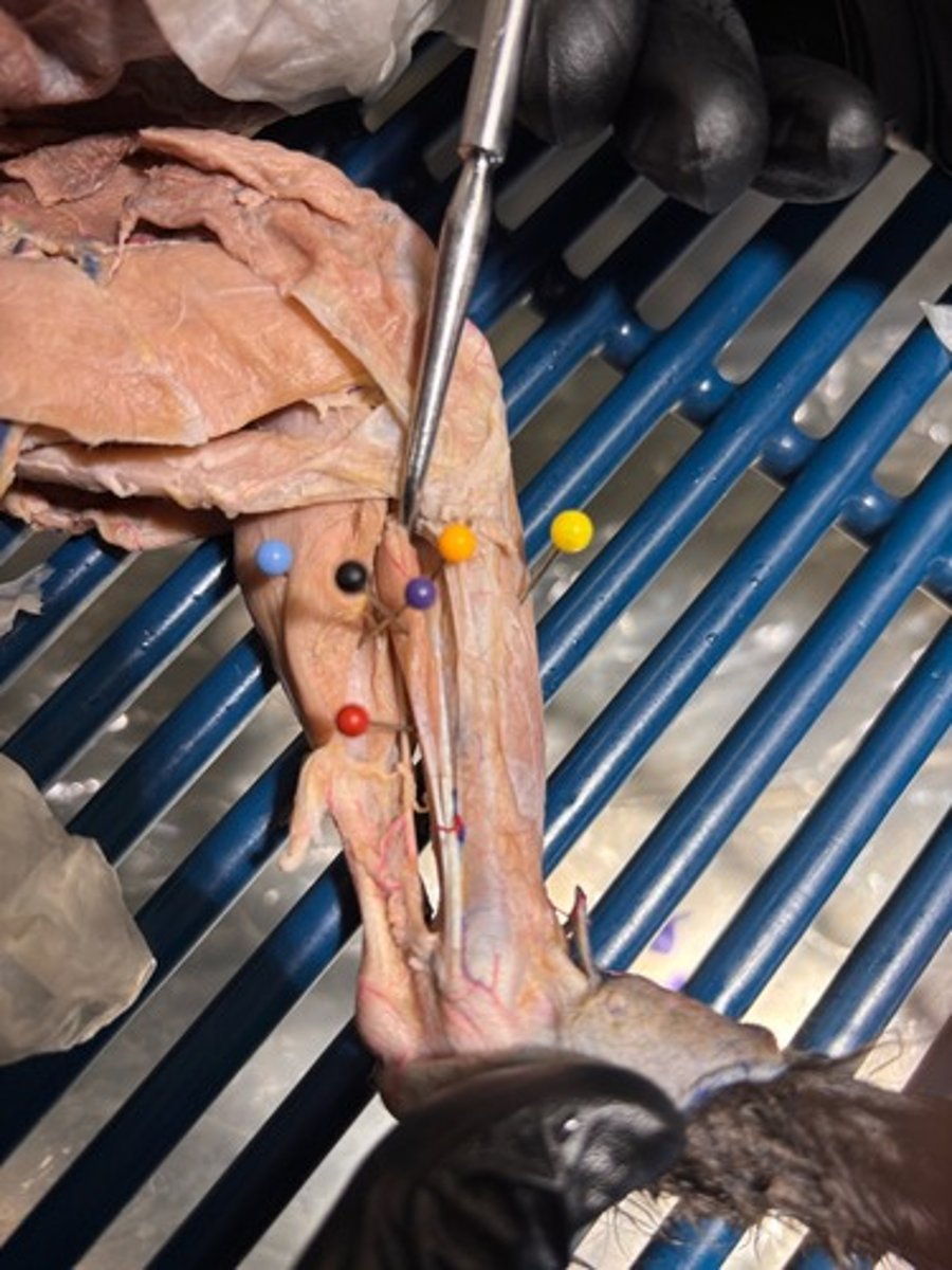 <p>What muscle of the shank is the purple pin in</p>