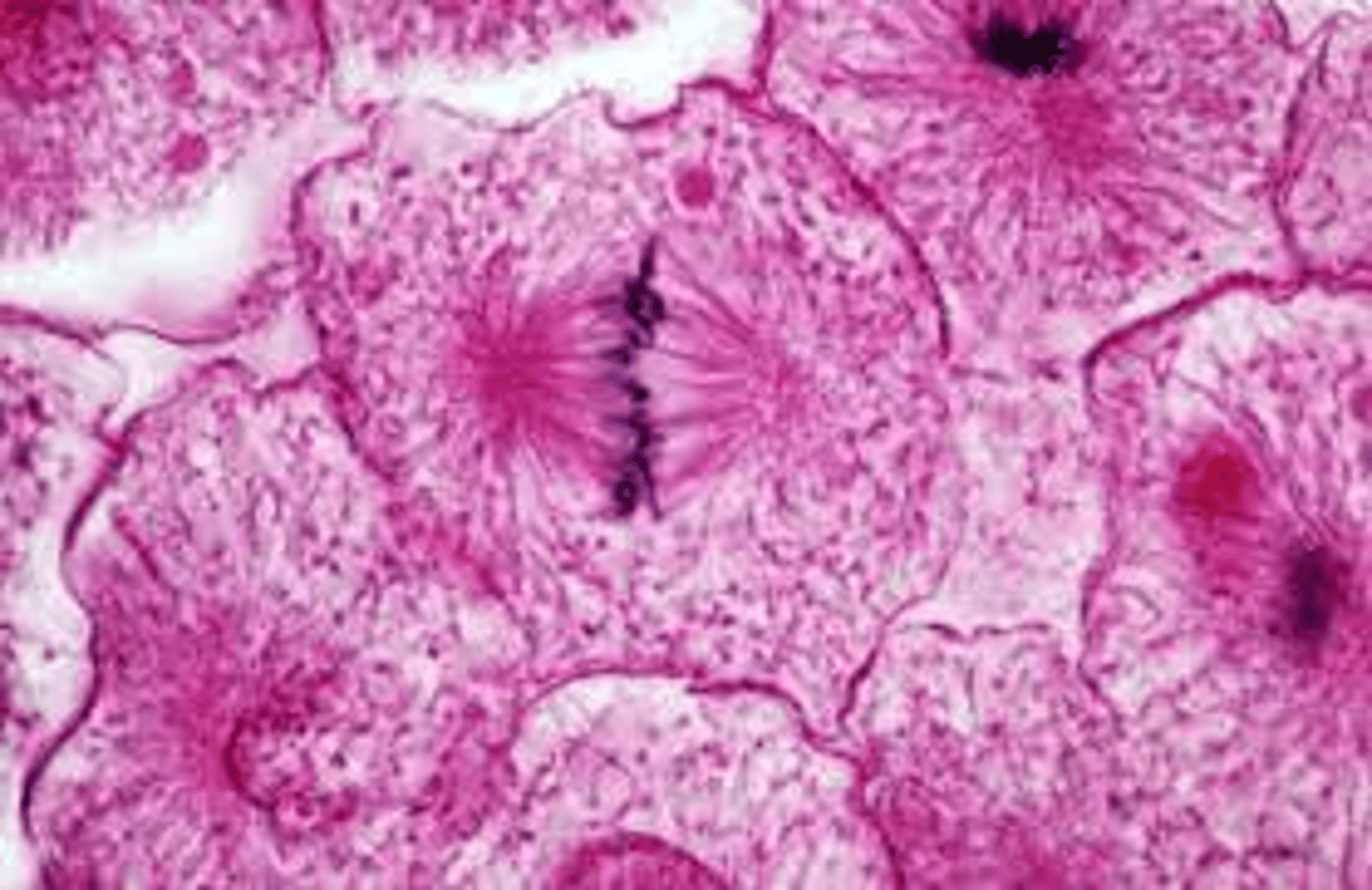 <p>chromosomes form a condensed bar shape mass across the center of the cell. Microtuosued form a spindle shape. Chromosomes are completely aligned and the mitotic apparatus is highly condensed.</p>