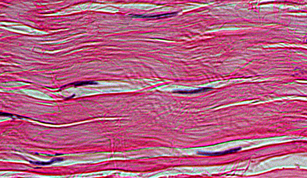 <p>What tissue is shown</p>
