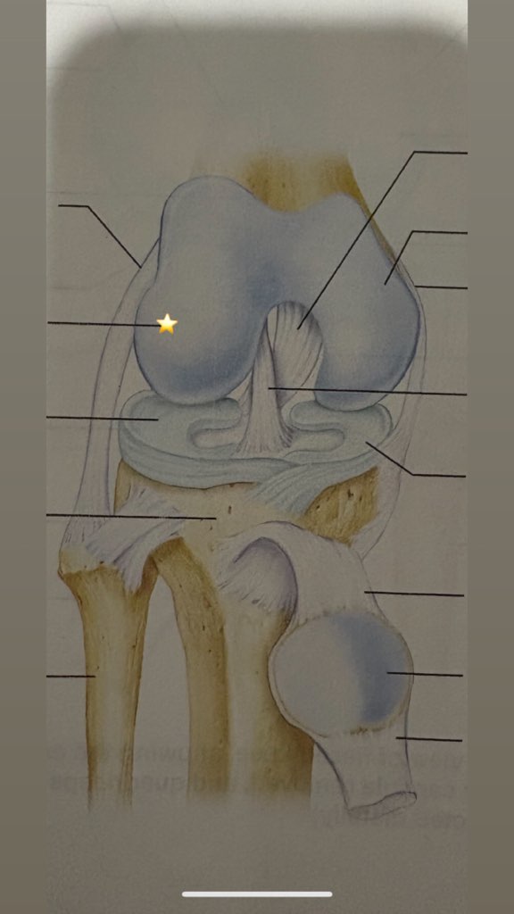 <p>Name the starred structure </p>