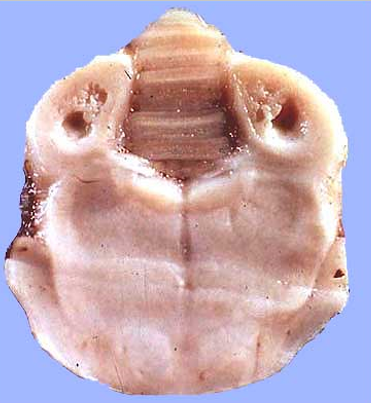 <p>10.<span>&nbsp; </span>Tissue from a dog.<span>&nbsp;&nbsp; </span>Which of the following is true?</p><ol type="a"><li><p>Affected ruminants have lesions in the brainstem nuclei rather than the periventricular nuclei.</p></li><li><p>Affected carnivores have elevated levels of blood pyruvate dehydrogenase.</p></li><li><p>Lesions are most often seen in the periventricular grey matter.</p></li><li><p>Phosphorylated thiamine is the coenzyme transketolase, which is involved in oxidative decarboxylase reactions throughout the body.</p></li></ol><p></p>