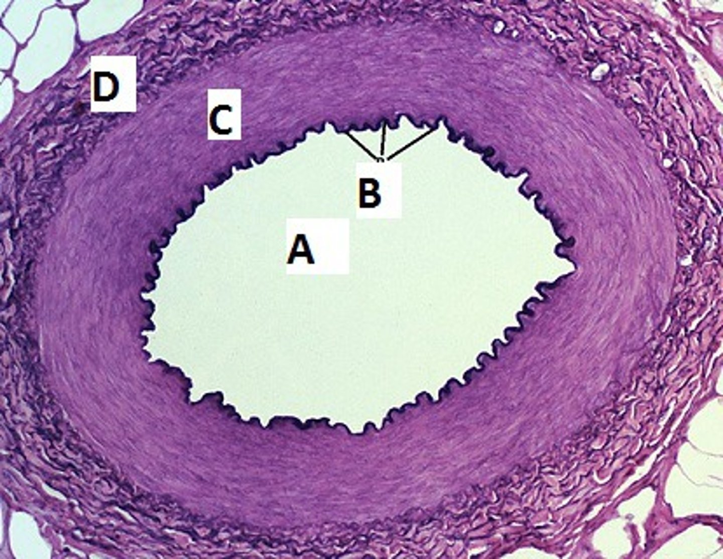 <p>An open space, such as within a blood vessel or the intestine or outside the body (A)</p>