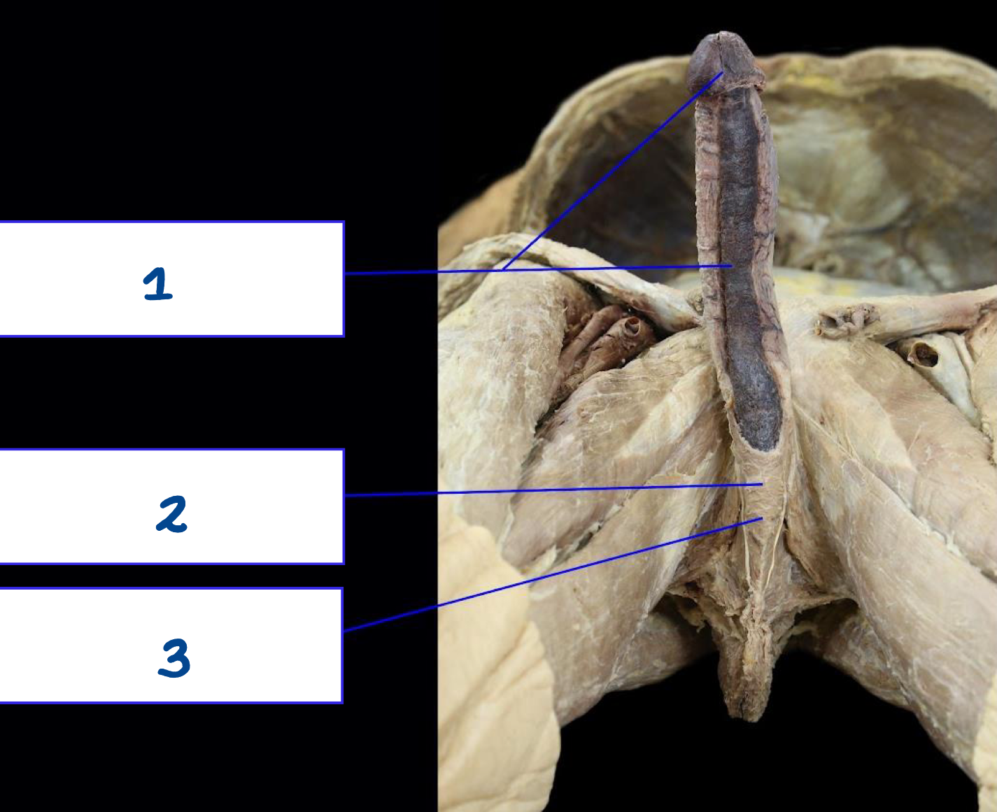 <p>What is structure 3?</p>
