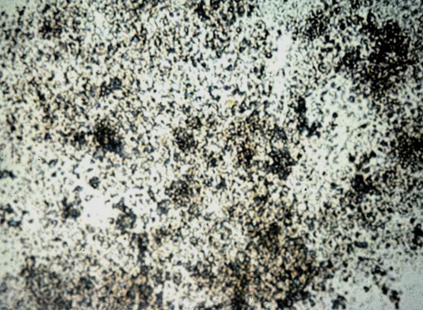 <p>Is this bacteria &amp; how can you confirm or deny this?</p><p>What crystals are these called?</p><p>What is the named of this crystal when present in alkaline urine?</p><p>What is the name of this crystal when present in acidic urine?</p>