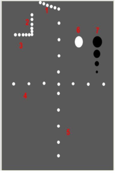 <p>The diagram represents a tissue phantom. The pins in the area listed as #1 are used to evaluate which of the following system parameters?</p><p>a. dead zone <br>b. axial resolution <br>c. contrast resolution <br>d. range resolution</p>
