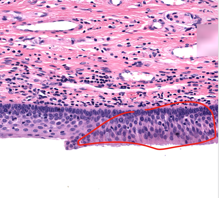 <p>(tissue type)</p>