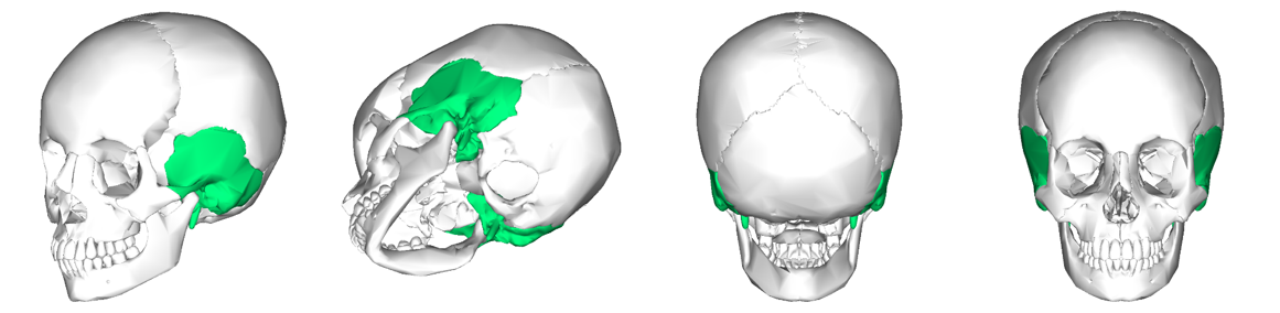 <p>Can you name what each view is of the temporal bones of the cranium?</p>